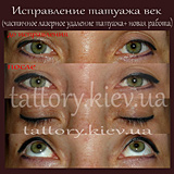 Виправлення татуажу