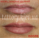 Виправлення татуажу