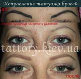 Виправлення татуажу