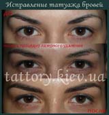 Виправлення татуажу
