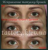 Виправлення татуажу