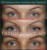 Виправлення татуажу
