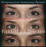 Виправлення татуажу