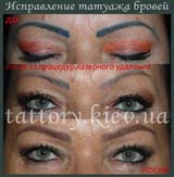 Виправлення татуажу