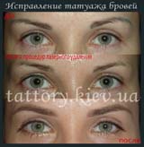 Виправлення татуажу