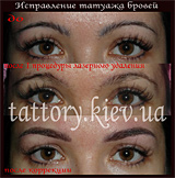 Виправлення татуажу