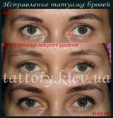 Виправлення татуажу