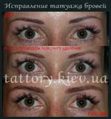 Виправлення татуажу