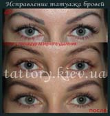 Виправлення татуажу