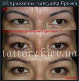 Виправлення татуажу