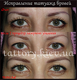 Виправлення татуажу