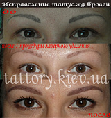 Виправлення татуажу